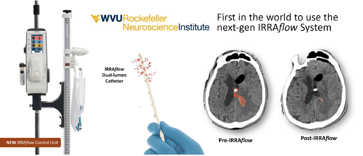 Wvu Rockefeller Neuroscience Institute Neurosurgeon First In The World To Treat Patient With 6686