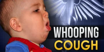 Whooping Cough Cases Surge Across the U.S., Prompting Public Health Warnings